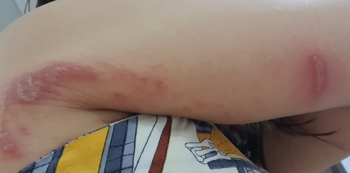 Nhiều người than trời v&igrave; kiến ba khoang "v&agrave;o m&ugrave;a"   - Ảnh 1.