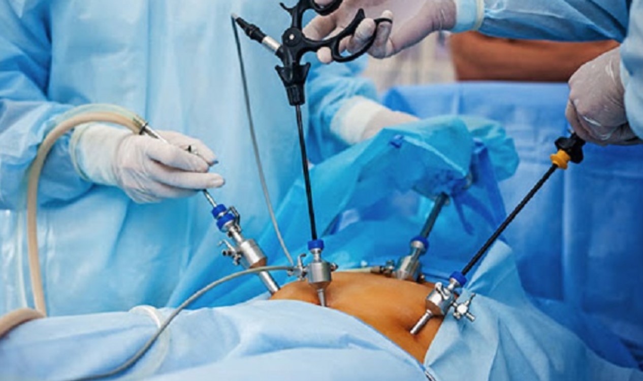 V&igrave; sao cần can thiệp sớm cho d&ugrave; sỏi t&uacute;i mật chưa c&oacute; triệu chứng? - Ảnh 1.