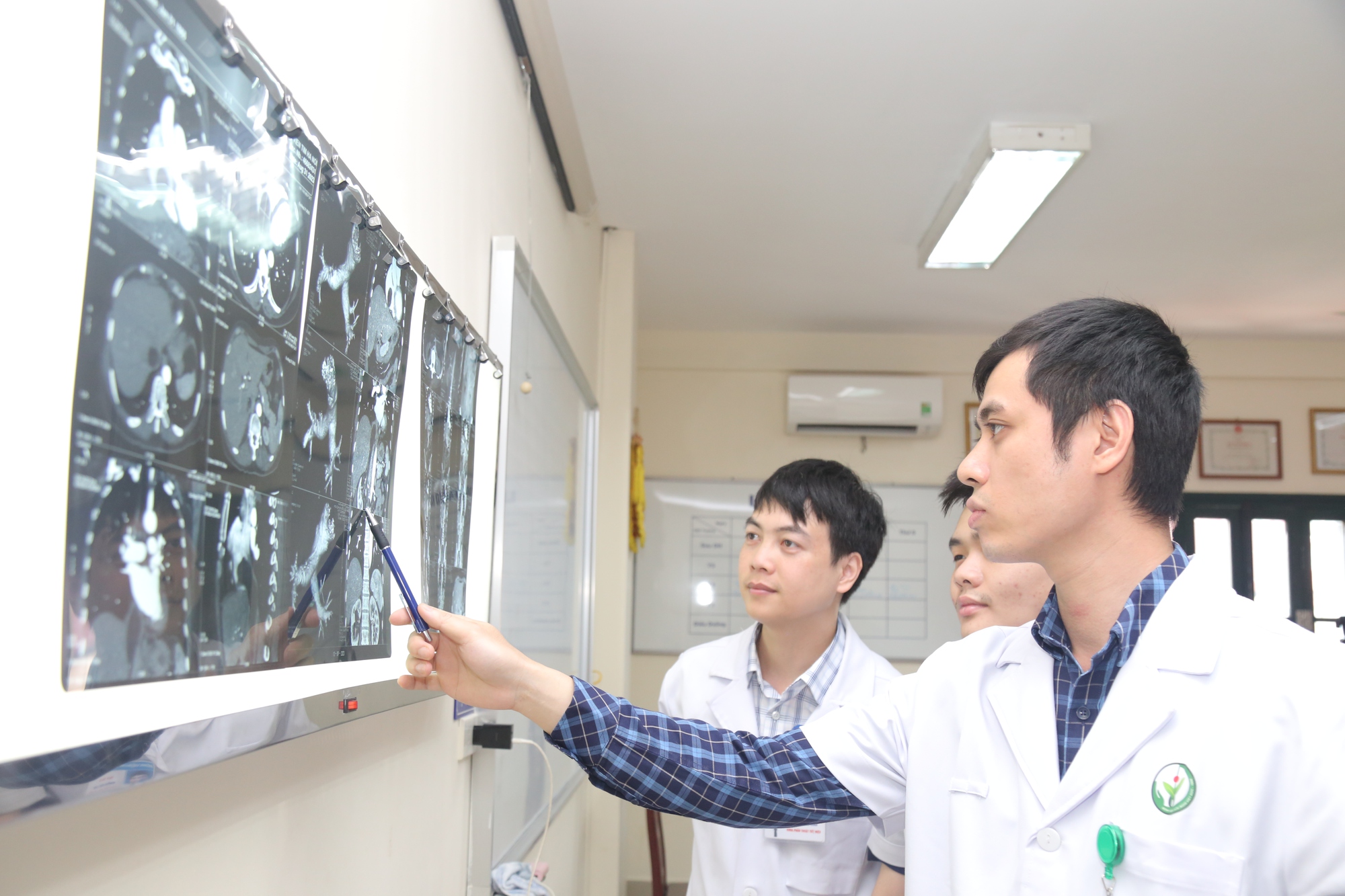 Lần đầu ti&ecirc;n tại Việt Nam phẫu thuật u cơ mỡ mạch thận lan l&ecirc;n đến tim   - Ảnh 2.