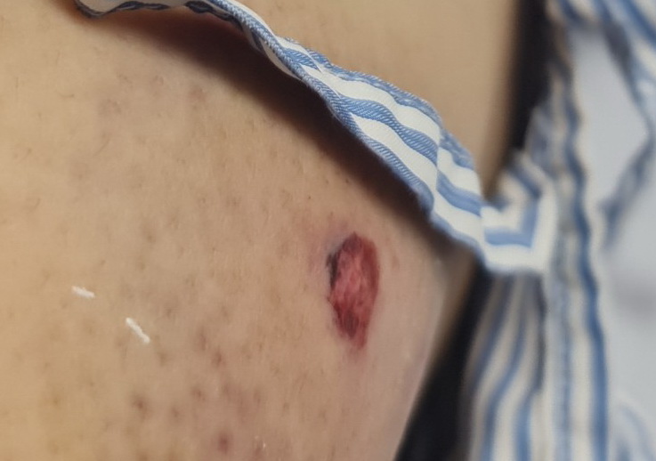 Hai c&ocirc;ng nh&acirc;n m&ocirc;i trường bị bắn: Nghi phạm từng hăm dọa xử bắn? - Ảnh 1.