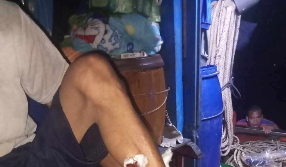 Khẩn trương điều tra vụ ngư d&acirc;n Ki&ecirc;n Giang bị tấn c&ocirc;ng tr&ecirc;n biển C&agrave; Mau - Ảnh 2.