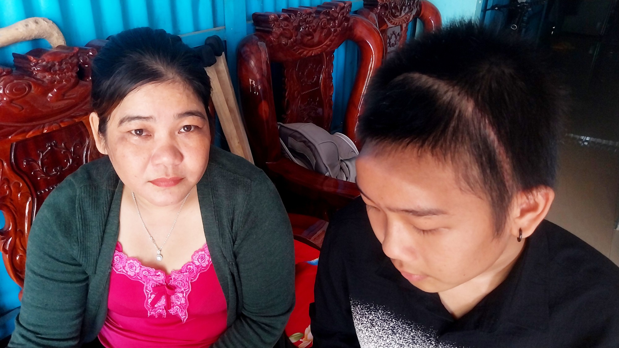 Đồng Th&aacute;p: Nỗi đau của hai mẹ con c&oacute; ho&agrave;n cảnh kh&oacute; khăn bị tai nạn giao th&ocirc;ng - Ảnh 2.