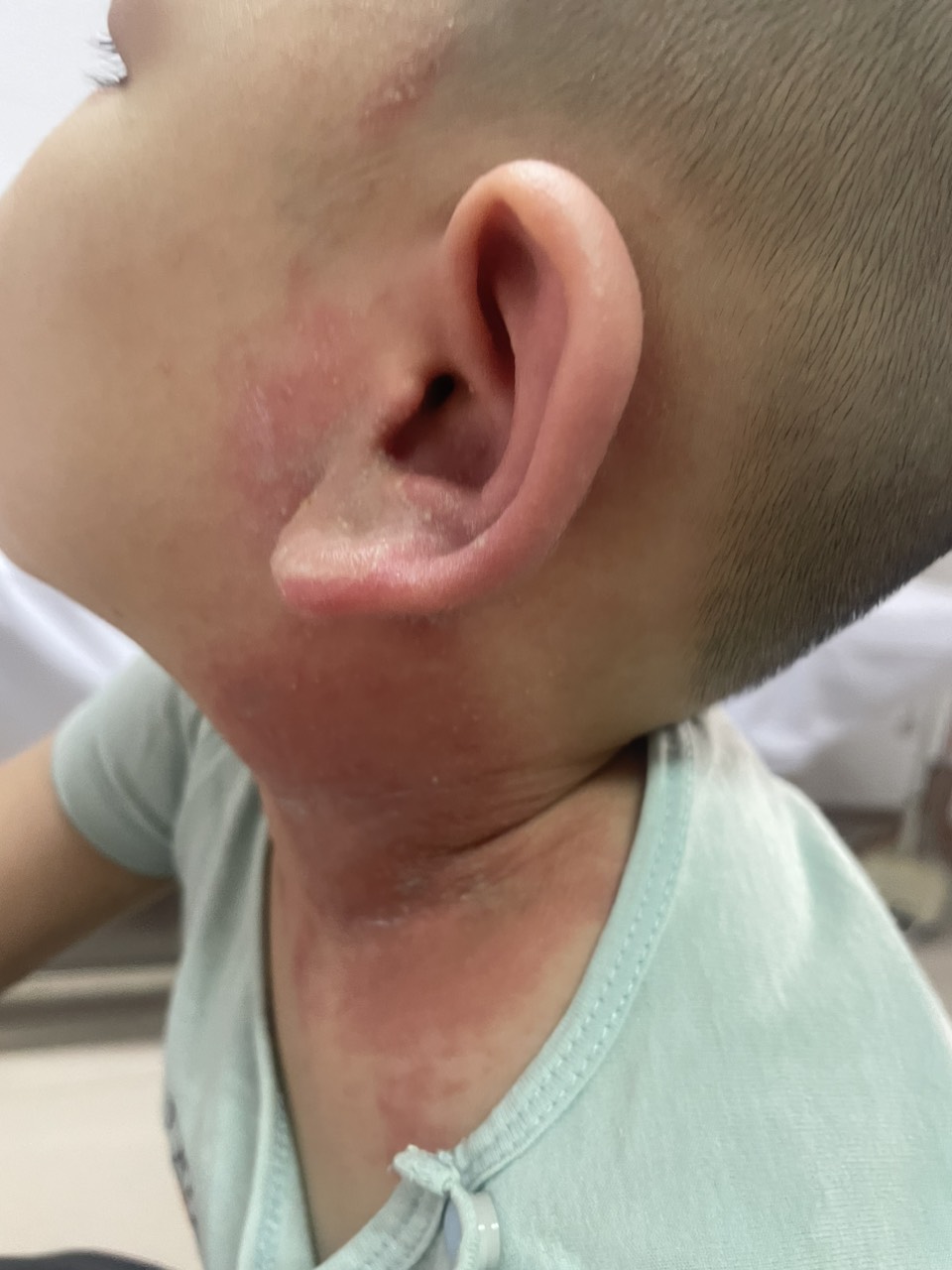 Nhiều người khốn khổ v&igrave; kiến ba khoang   - Ảnh 2.