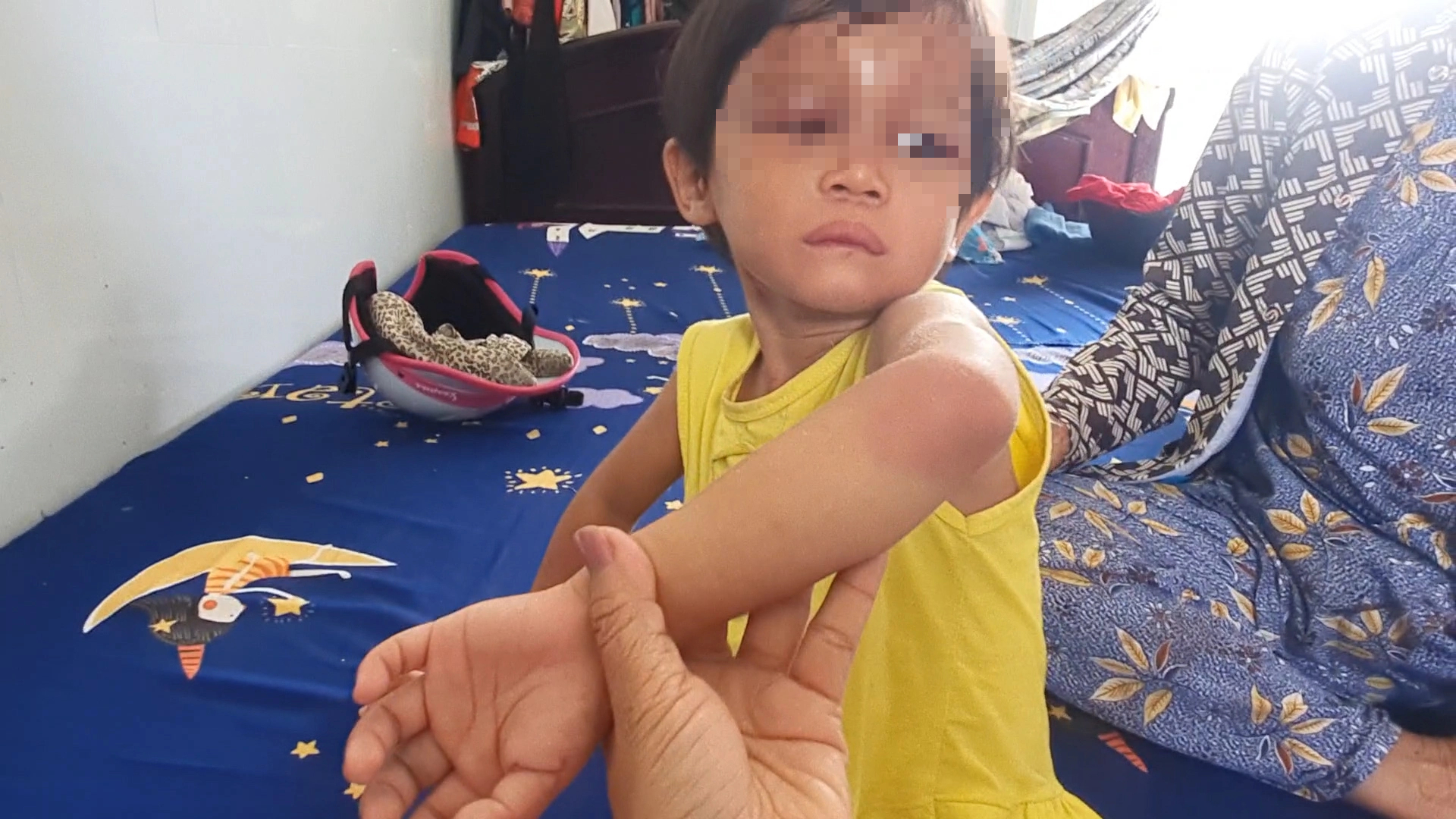 Vụ b&eacute; g&aacute;i 4 tuổi ở C&agrave; Mau nghi bị đ&aacute;nh đập: Cha nu&ocirc;i nhiều lần đ&aacute;nh con - Ảnh 1.