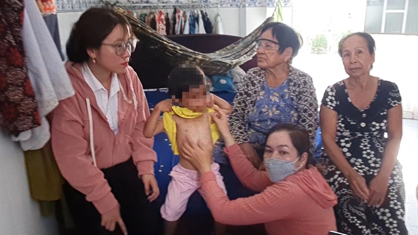 Kịp thời thăm hỏi b&eacute; g&aacute;i 4 tuổi nghi bị cha nu&ocirc;i đ&aacute;nh đập ở C&agrave; Mau - Ảnh 1.