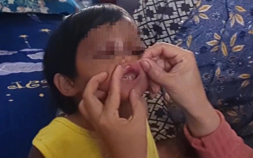 Bảo vệ khẩn cấp b&eacute; g&aacute;i 4 tuổi ở C&agrave; Mau bị cha nu&ocirc;i đ&aacute;nh đập