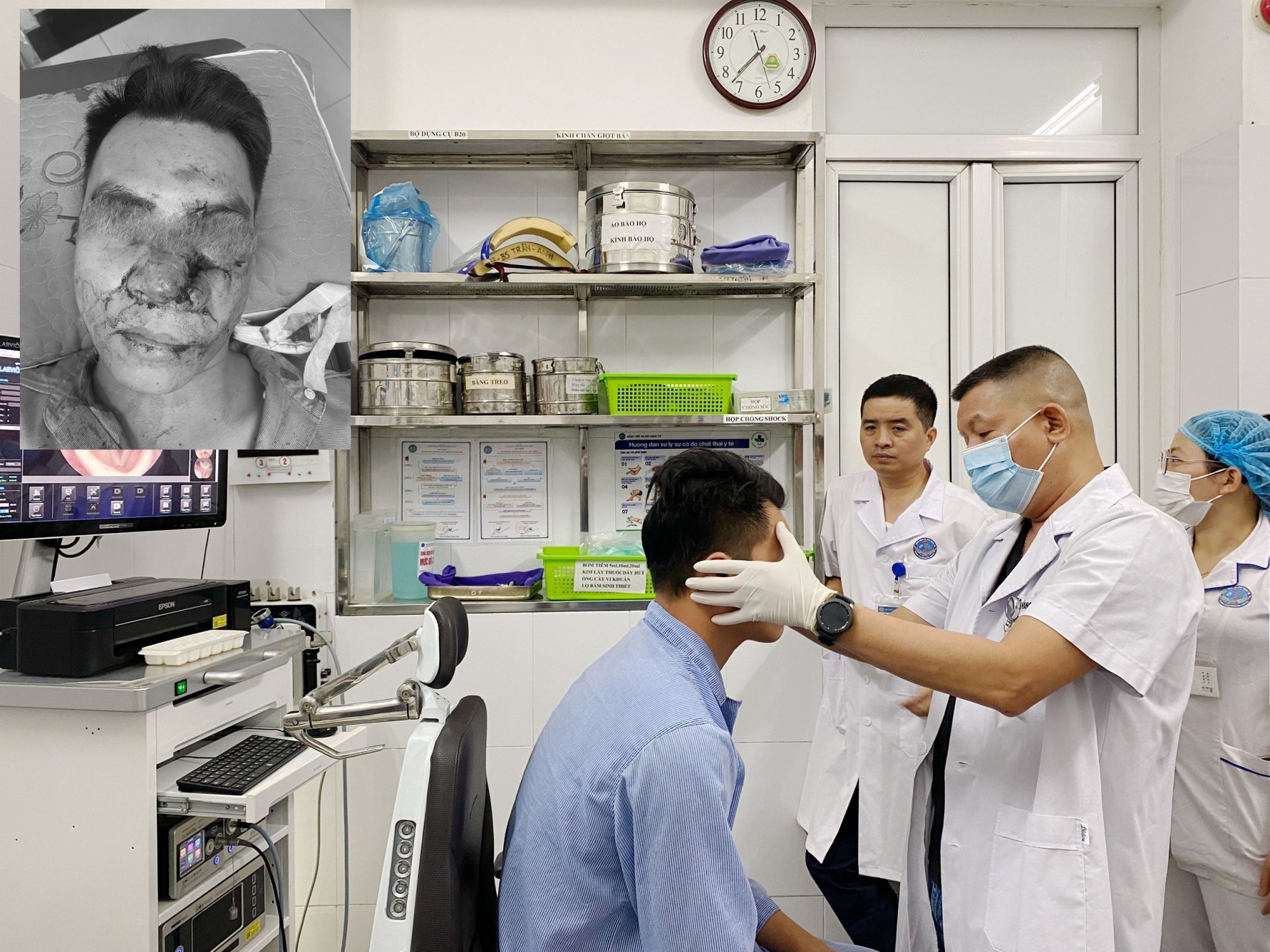 Phục hồi th&agrave;nh c&ocirc;ng khu&ocirc;n mặt biến dạng sau TNGT cho nam thanh ni&ecirc;n - Ảnh 1.