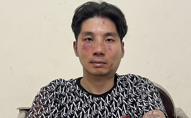 Khởi tố vụ &aacute;n đối tượng cầm dao cướp t&agrave;i sản, đ&acirc;m trọng thương trung t&aacute; c&ocirc;ng an - Ảnh 1.