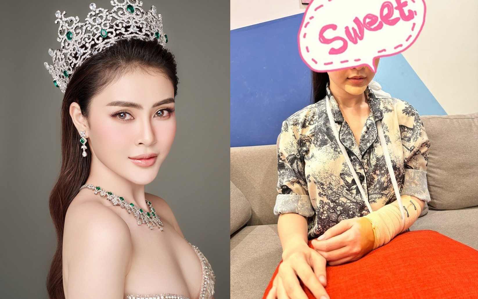 Người đẹp dừng thi Miss Universe Vietnam 2023 v&igrave; tai nạn giao th&ocirc;ng, sức khỏe giờ ra sao?
