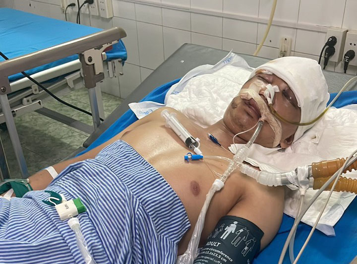 C&aacute;m cảnh bị TNGT ở Tuy&ecirc;n Quang cần được gi&uacute;p đỡ - Ảnh 2.