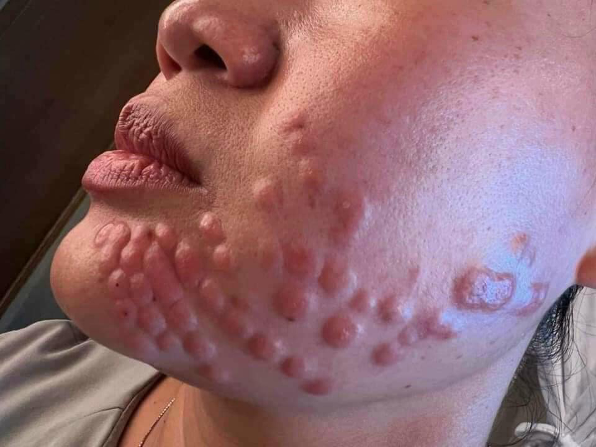 Rước vạ v&igrave; ham l&agrave;m đẹp cấp tốc đ&oacute;n Tết- Ảnh 1.