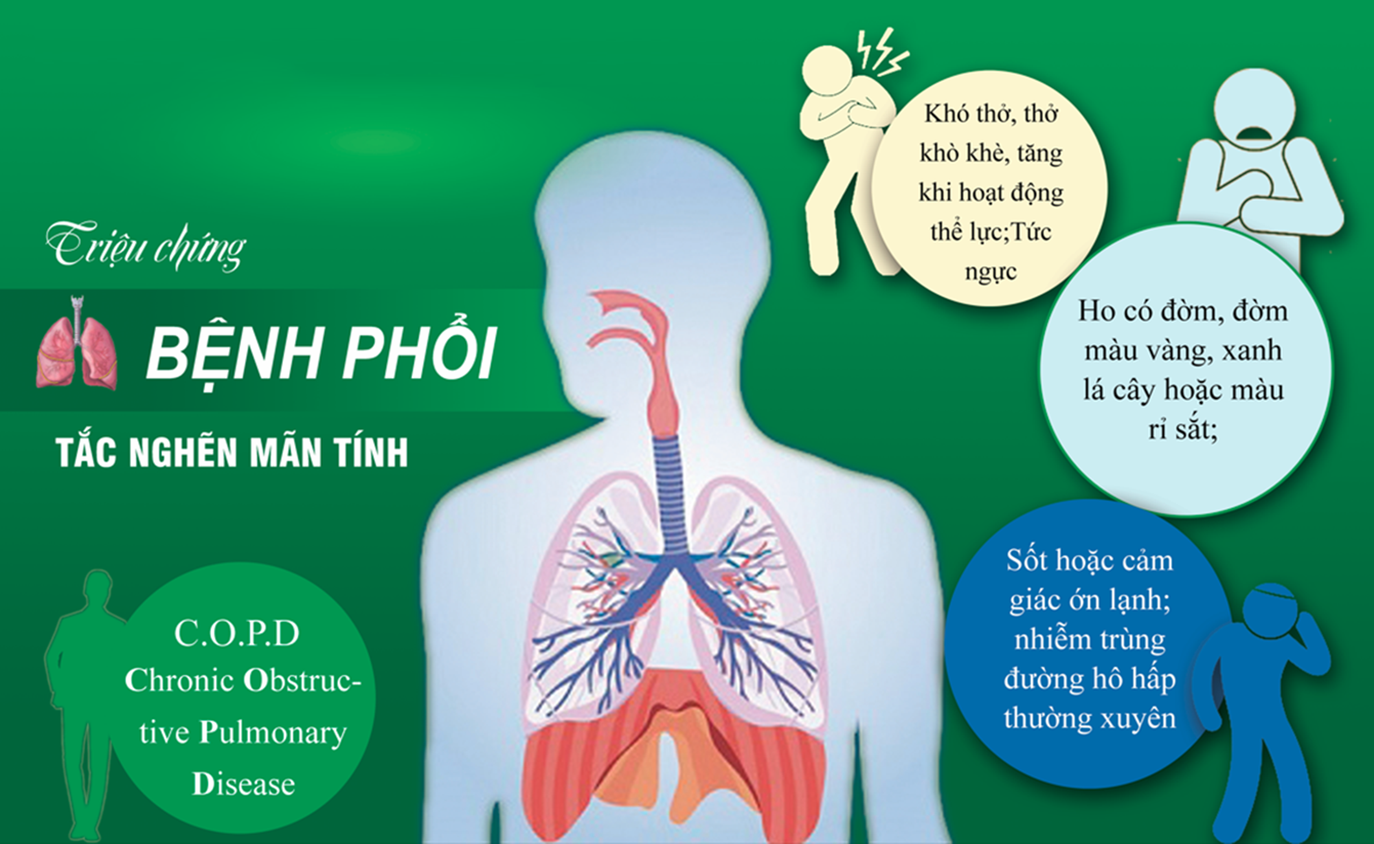 Phổi tắc nghẽn mạn t&iacute;nh c&oacute; thể chữa khỏi ho&agrave;n to&agrave;n?- Ảnh 1.
