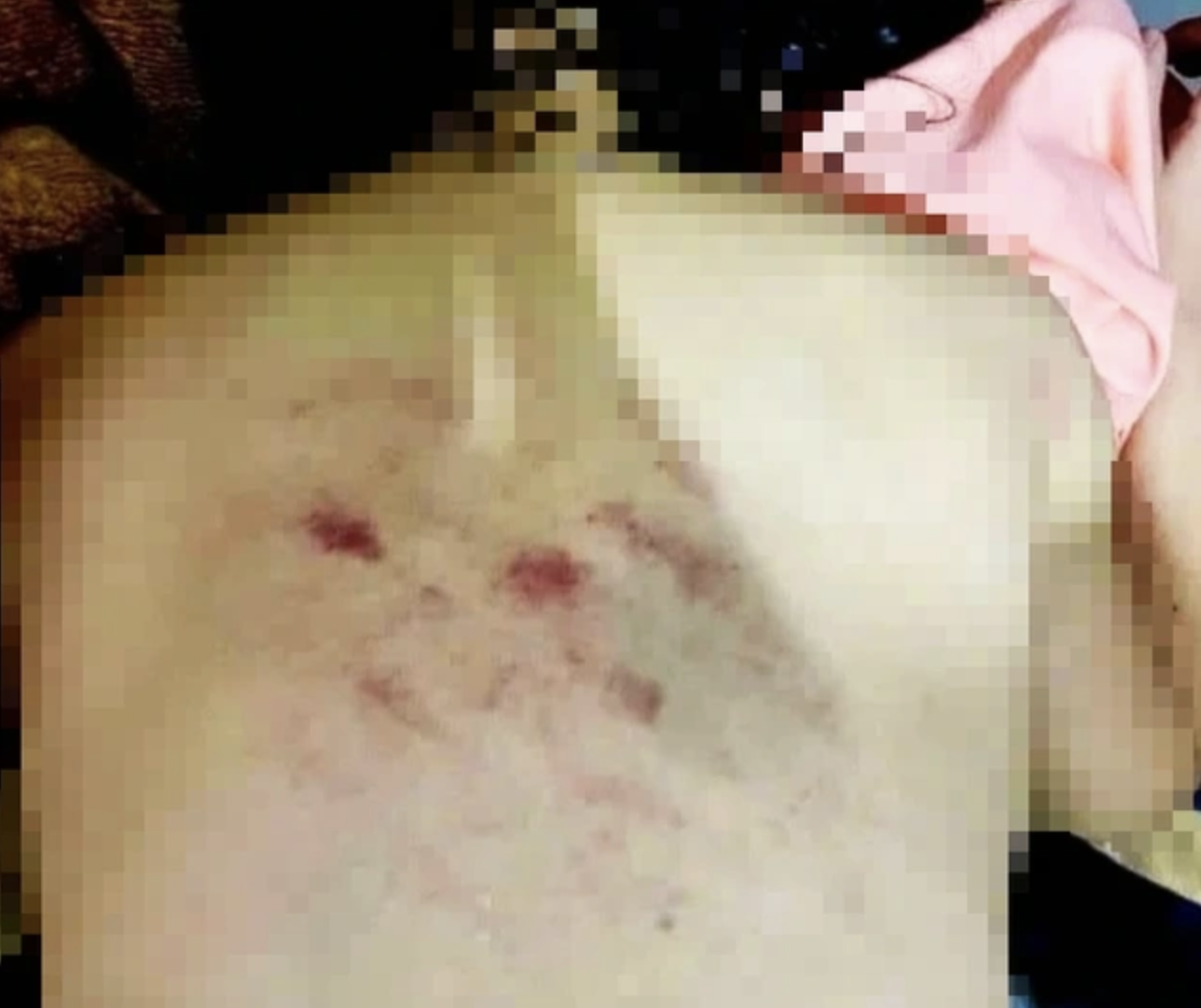 Vụ c&ocirc; gi&aacute;o đ&aacute;nh học sinh lớp 1 bầm t&iacute;m: Chuyển hồ sơ sang c&ocirc;ng an xử l&yacute;- Ảnh 2.