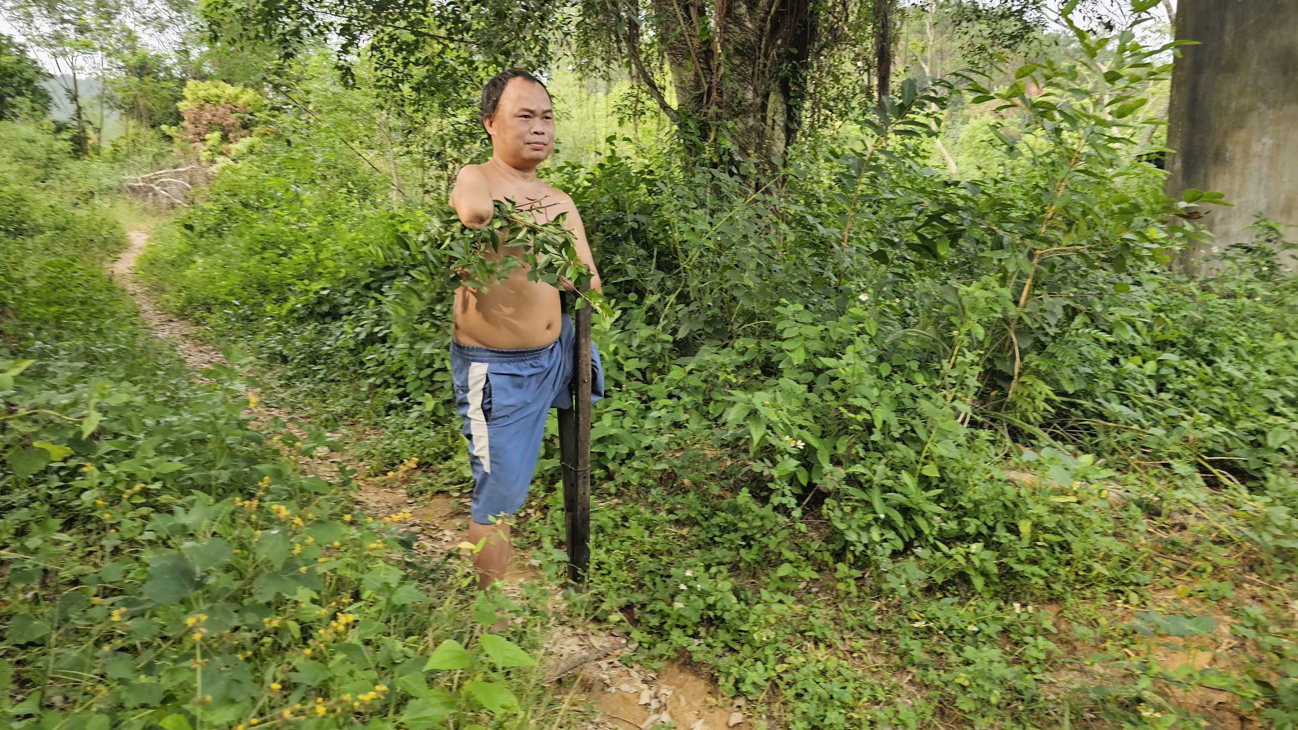 Nghị lực cậu bé sống sót sau vụ nổ bom bi- Ảnh 2. Nghị lực cậu bé sống sót sau vụ nổ bom bi- Ảnh 2.