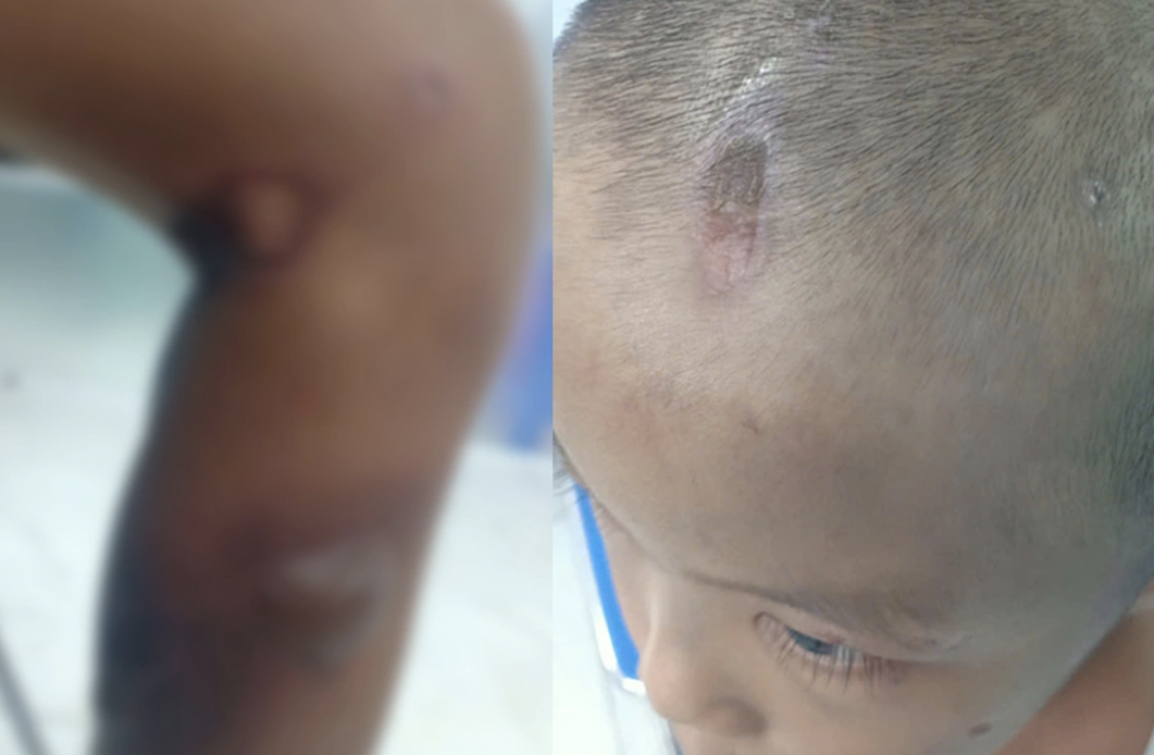 Khởi tố, bắt tạm giam cha đẻ v&agrave; mẹ kế h&agrave;nh hạ con trai 6 tuổi- Ảnh 2.