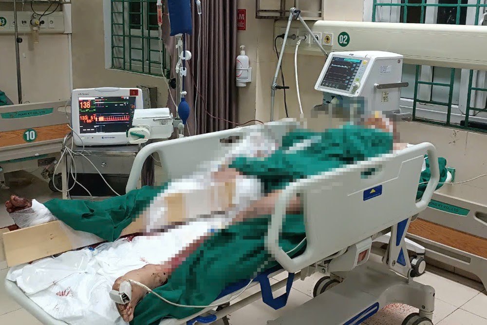 Cửa nh&agrave; vỡ vụn sau tiếng nổ lớn, nam thanh ni&ecirc;n trọng thương- Ảnh 1.