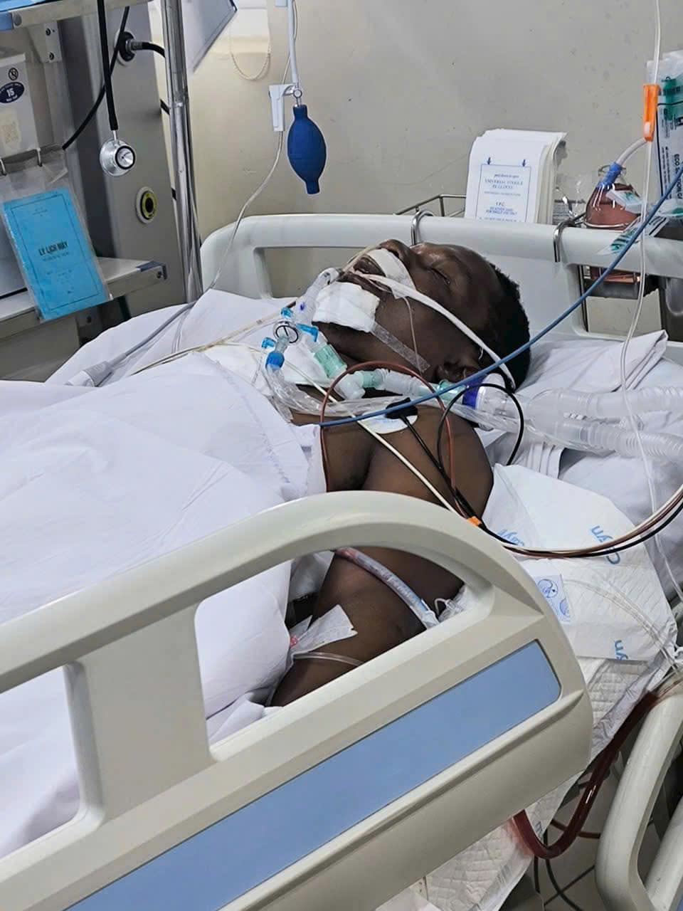 Cựu sao V-League bị tai nạn thương t&acirc;m v&igrave; đuổi theo cướp- Ảnh 1.