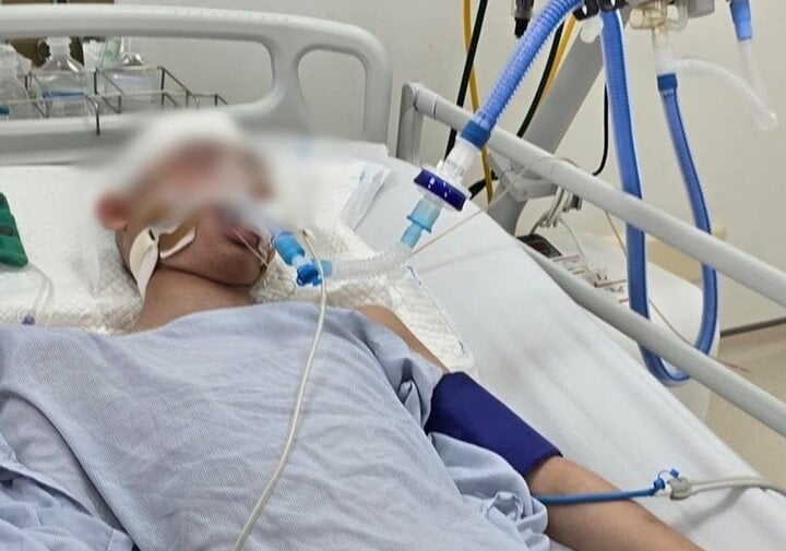 X&eacute;t xử vụ đ&aacute;nh nam sinh lớp 8 chết n&atilde;o: Bị c&aacute;o 16 tuổi sốt ph&aacute;t ban, kh&ocirc;ng thể tới to&agrave;- Ảnh 2.