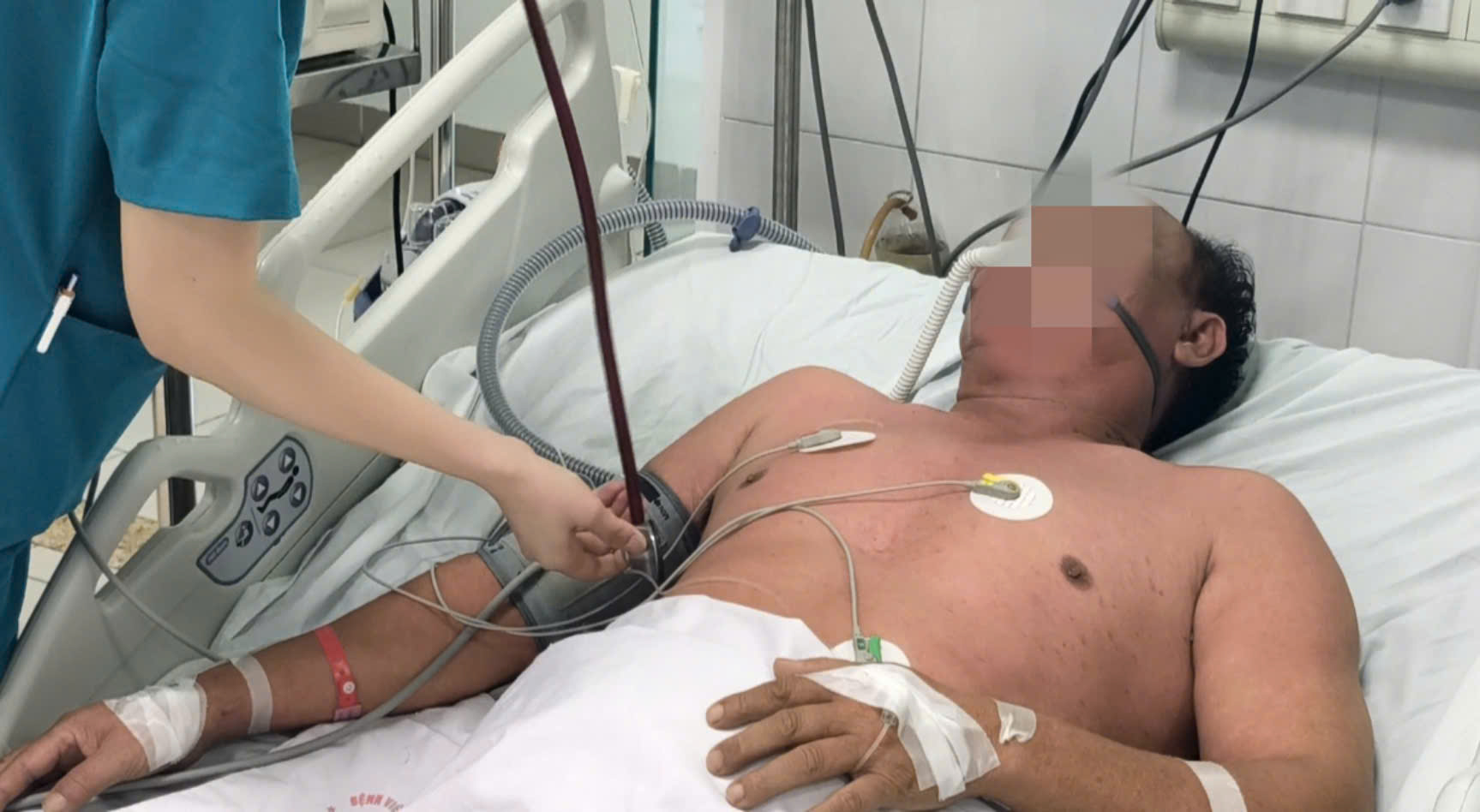 Hi hữu ca bệnh 56 tuổi suy h&ocirc; hấp cấp do sởi- Ảnh 1.