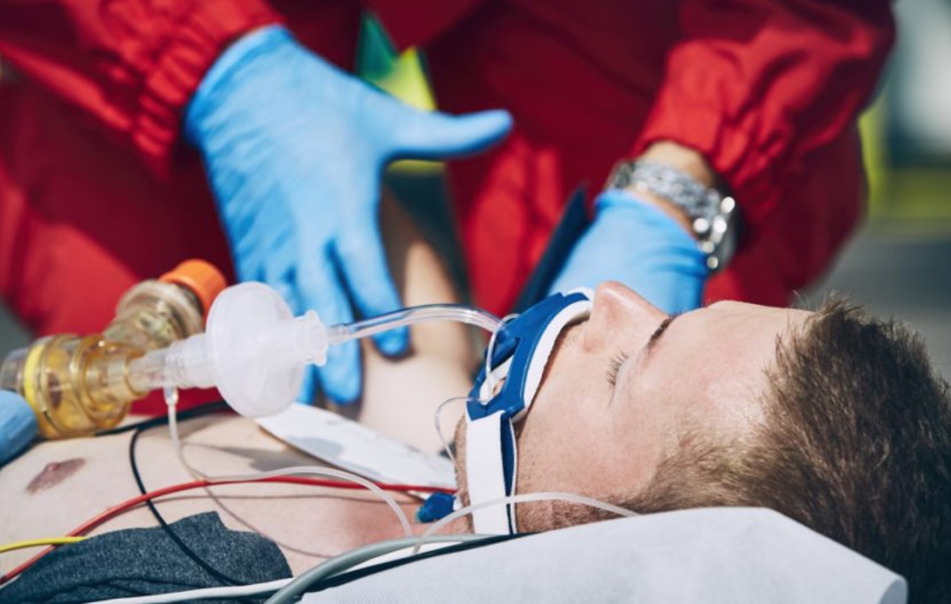 Cấp cứu thành công cho người đàn ông nguy kịch do TNGT- Ảnh 1. Cấp cứu thành công cho người đàn ông nguy kịch do TNGT- Ảnh 1.