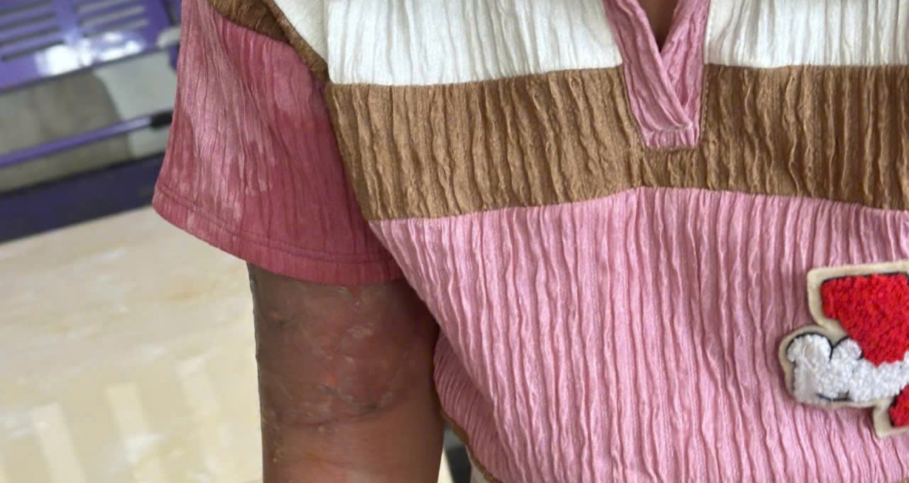 Khởi tố người phụ nữ tạt nước s&ocirc;i v&agrave;o con g&aacute;i nu&ocirc;i chỉ v&igrave; mất v&eacute; số- Ảnh 2.