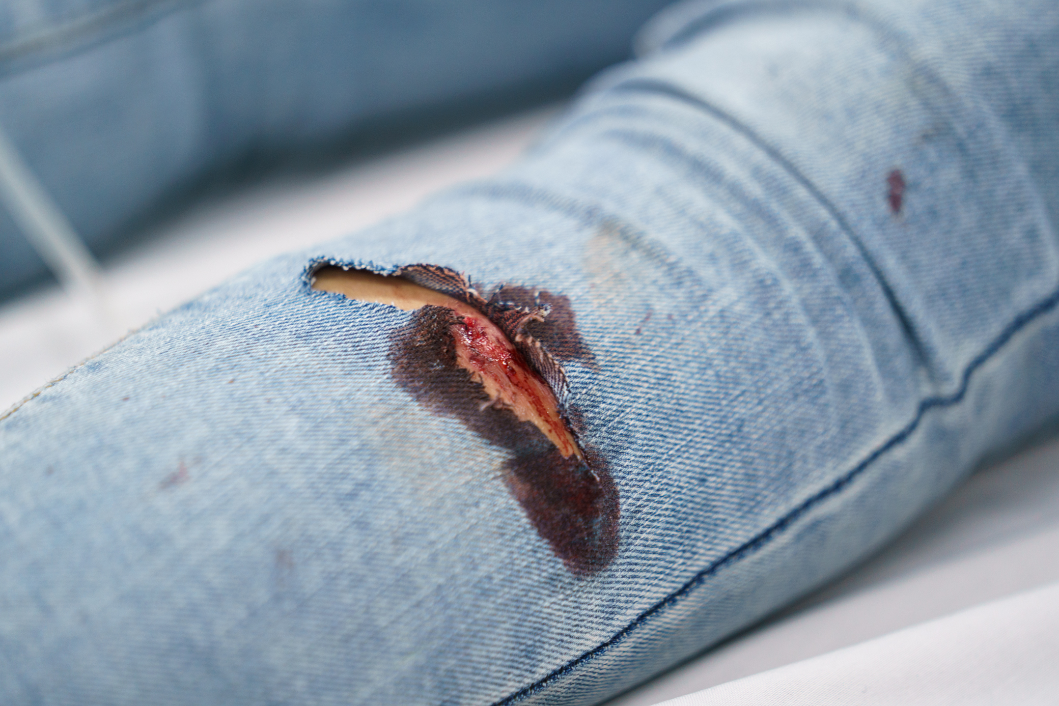 Xuyên đêm mùng 2 Tết cấp cứu nhiều ca tai nạn giao thông tại Bệnh viện Chợ Rẫy- Ảnh 8. Xuyên đêm mùng 2 Tết cấp cứu nhiều ca tai nạn giao thông tại Bệnh viện Chợ Rẫy- Ảnh 8.