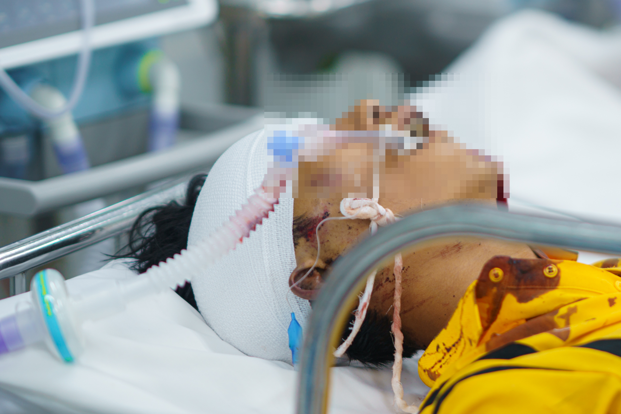 Xuyên đêm mùng 2 Tết cấp cứu nhiều ca tai nạn giao thông tại Bệnh viện Chợ Rẫy- Ảnh 9. Xuyên đêm mùng 2 Tết cấp cứu nhiều ca tai nạn giao thông tại Bệnh viện Chợ Rẫy- Ảnh 9.