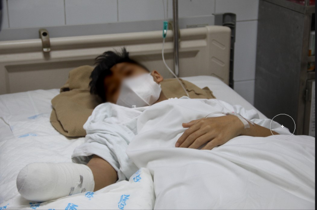 Nhiều người nhập viện, tiên lượng xấu sau tai nạn giao thông do uống rượu bia- Ảnh 11. Nhiều người nhập viện, tiên lượng xấu sau tai nạn giao thông do uống rượu bia- Ảnh 11.