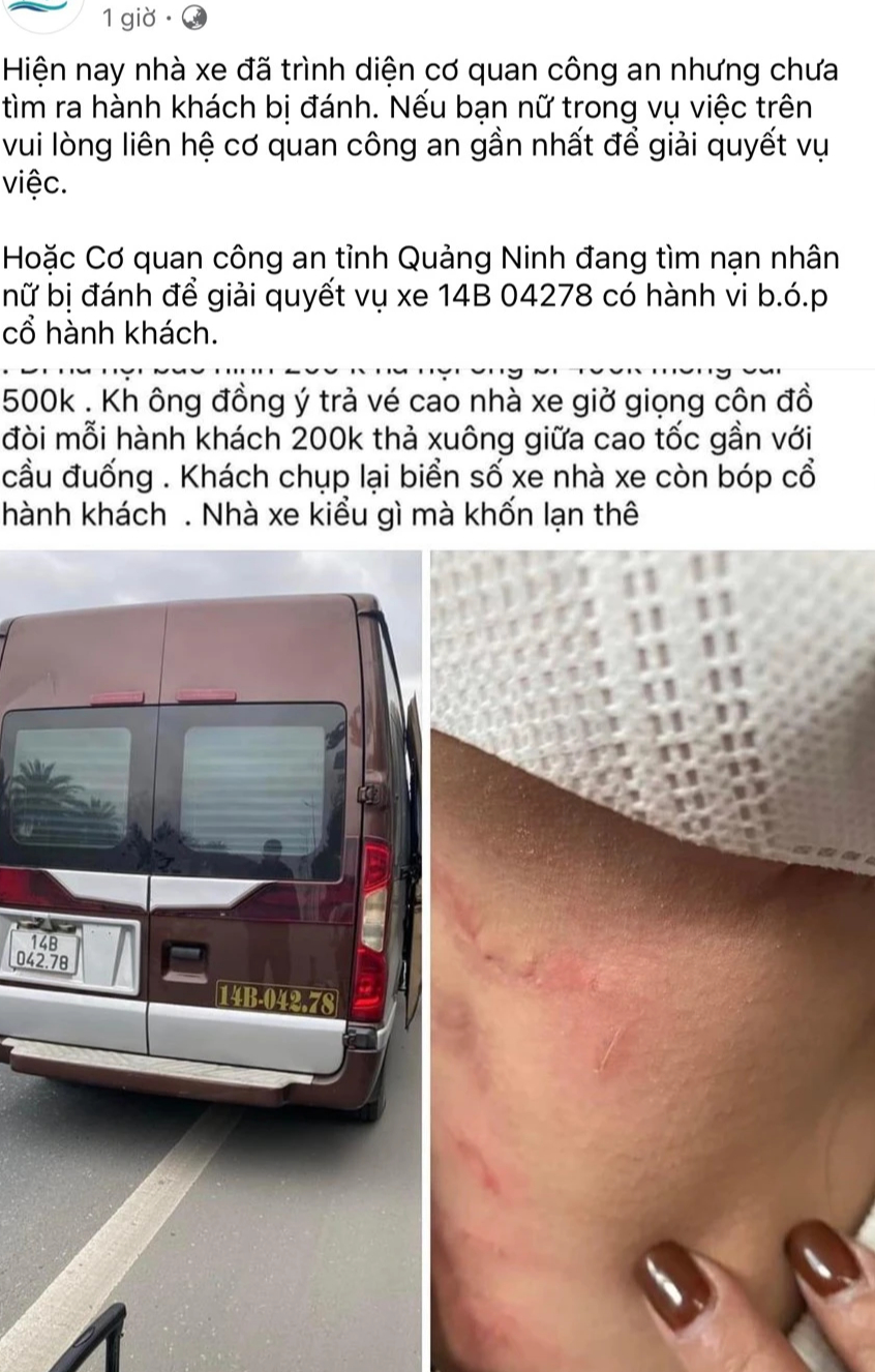 Nữ h&agrave;nh kh&aacute;ch tố bị b&oacute;p cổ: Tạm giữ xe limousine chạy d&ugrave;, xem x&eacute;t phạt nhiều lỗi- Ảnh 2.