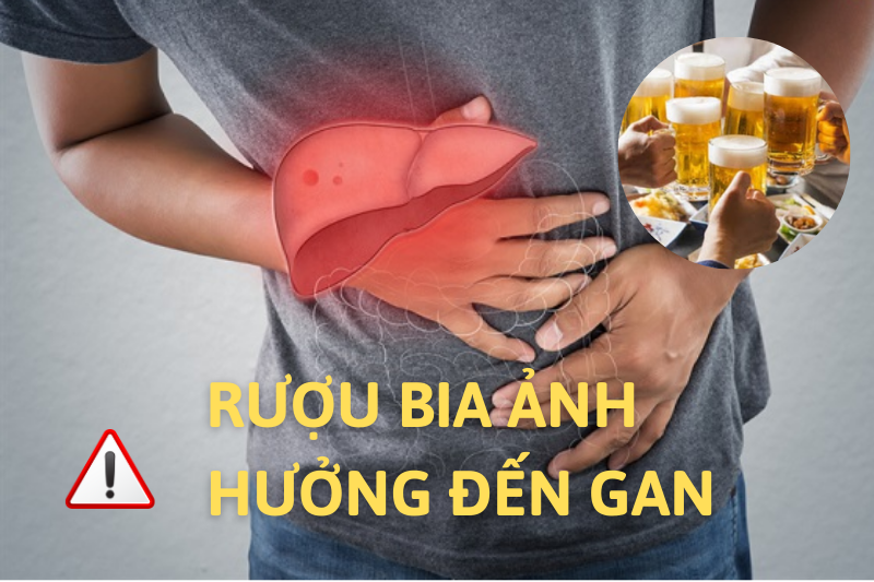 Giải độc gan Lifamax hiệu quả với người thường xuyên sử dụng rượu bia, thuốc lá- Ảnh 1. Giải độc gan Lifamax hiệu quả với người thường xuyên sử dụng rượu bia, thuốc lá- Ảnh 1.