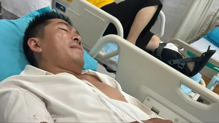 L&acirc;m Đồng: Một thẩm ph&aacute;n bị trộm ch&eacute;m trọng thương- Ảnh 1.