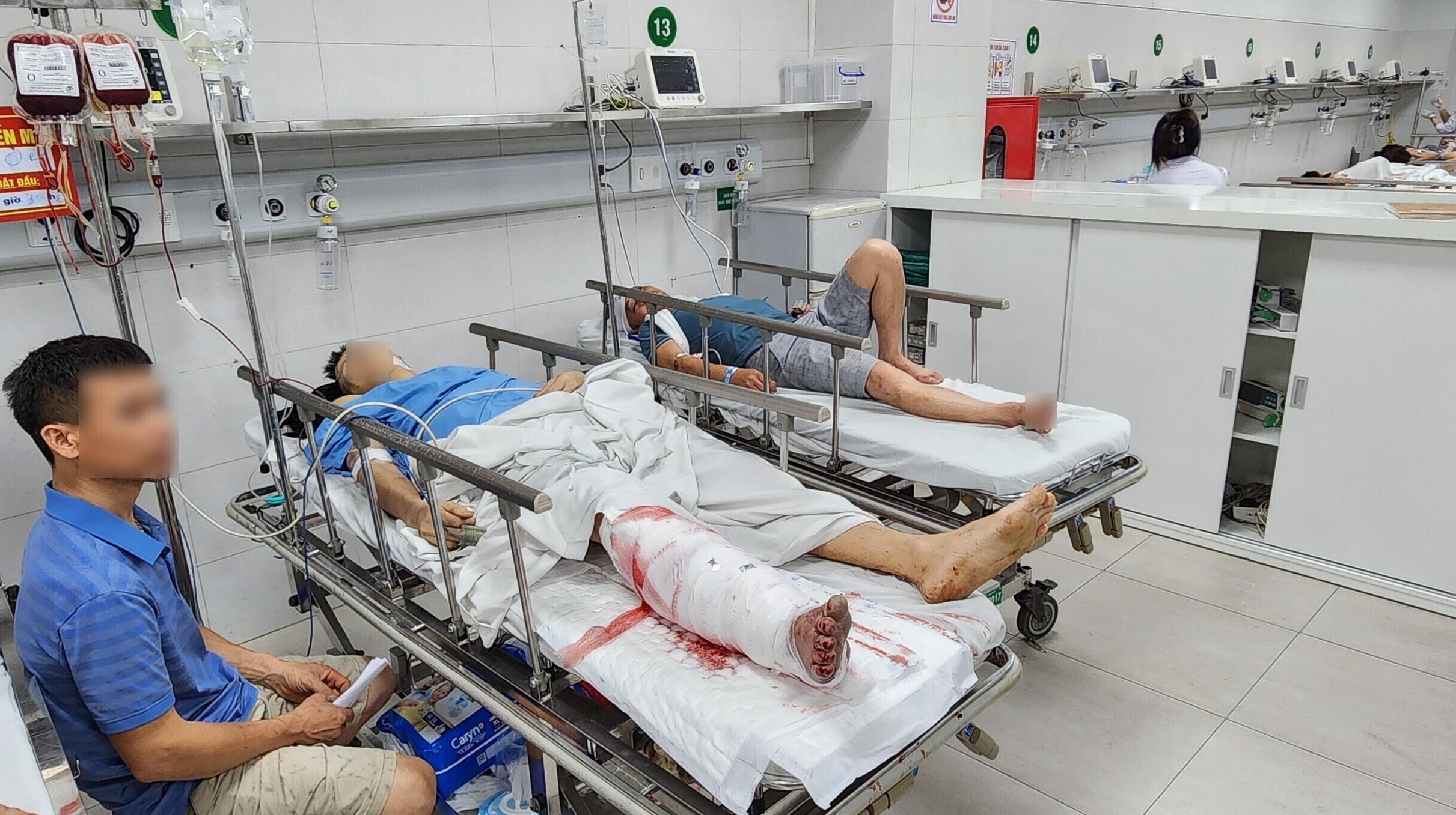 50% ca cấp cứu tại "thủ phủ ngoại khoa" BV Hữu nghị Việt Đức do TNGT- Ảnh 7. 50% ca cấp cứu tại "thủ phủ ngoại khoa" BV Hữu nghị Việt Đức do TNGT- Ảnh 7.