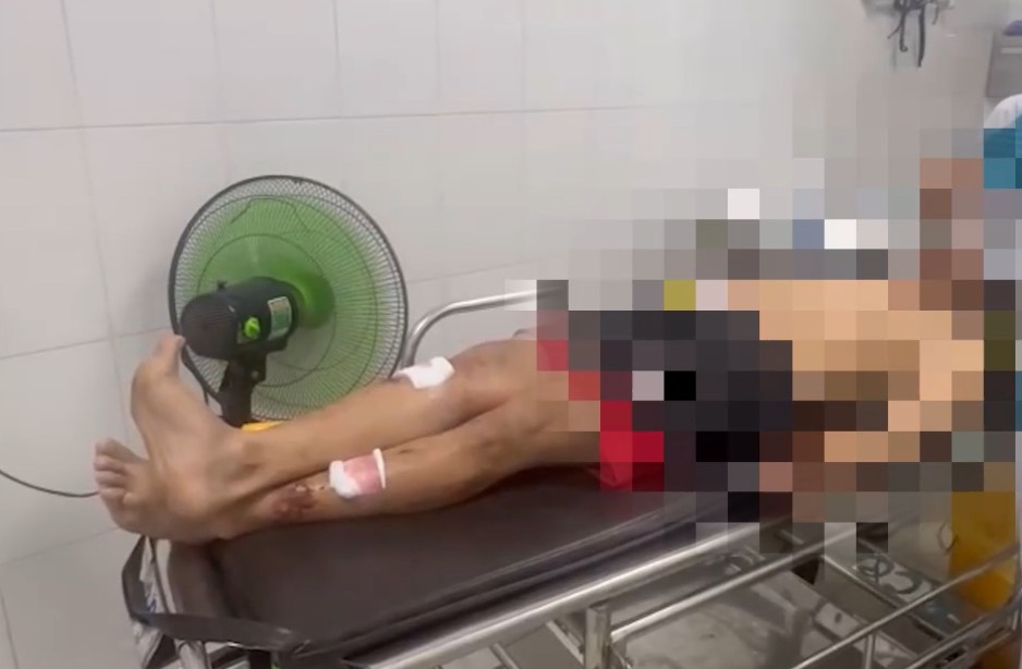 Bệnh viện Thống Nhất huy động to&agrave;n lực cứu bệnh nh&acirc;n vụ nổ l&ograve; hơi- Ảnh 2.