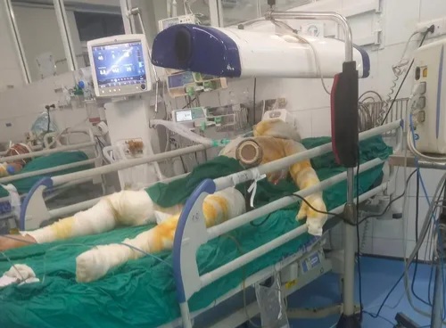 X&oacute;t xa b&eacute; sơ sinh 19 ng&agrave;y tuổi tử vong do bị bỏng
- Ảnh 2.