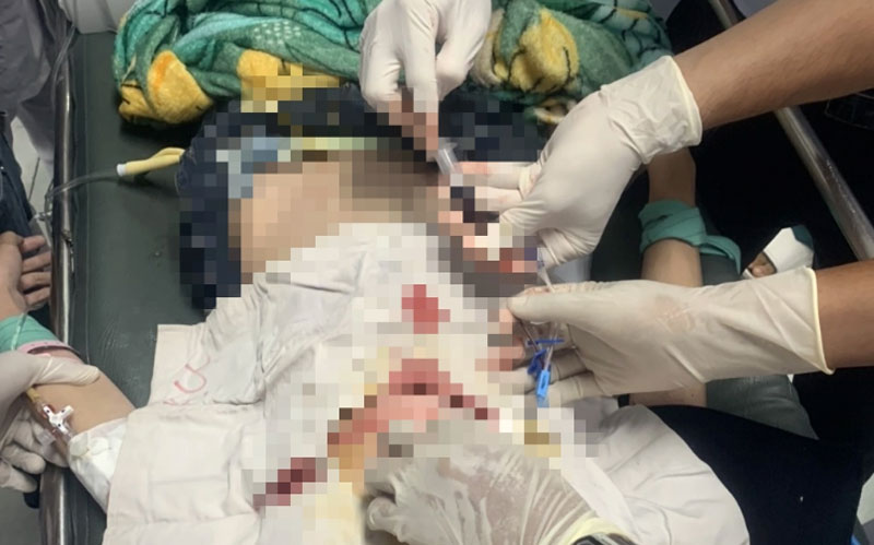 Sau khi xảy ra tai nạn, Y được người d&acirc;n kịp thời đưa v&agrave;o Bệnh viện Đa khoa Bạc Li&ecirc;u cấp cứu, hiện sức khỏe tạm ổn.