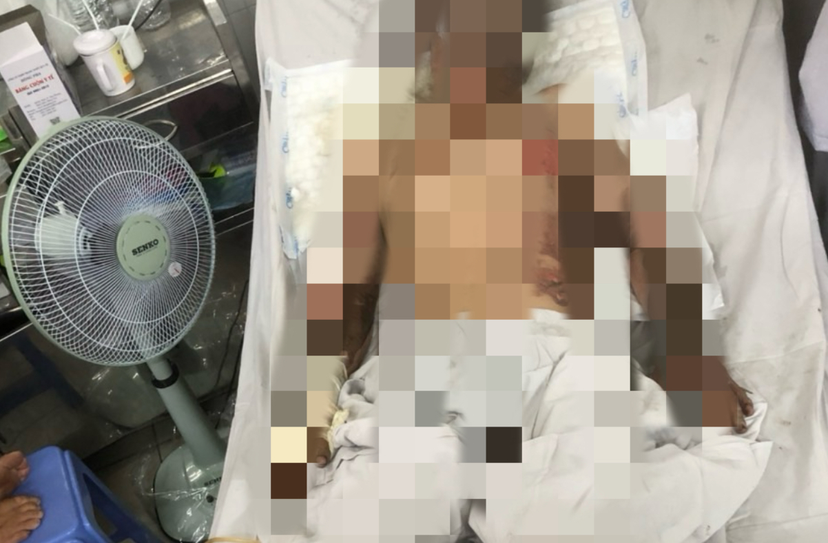 Vụ ch&aacute;y lớn ở c&ocirc;ng ty gi&agrave;y d&eacute;p tại Đồng Nai: Một nam nh&acirc;n vi&ecirc;n bị bỏng nặng- Ảnh 1.