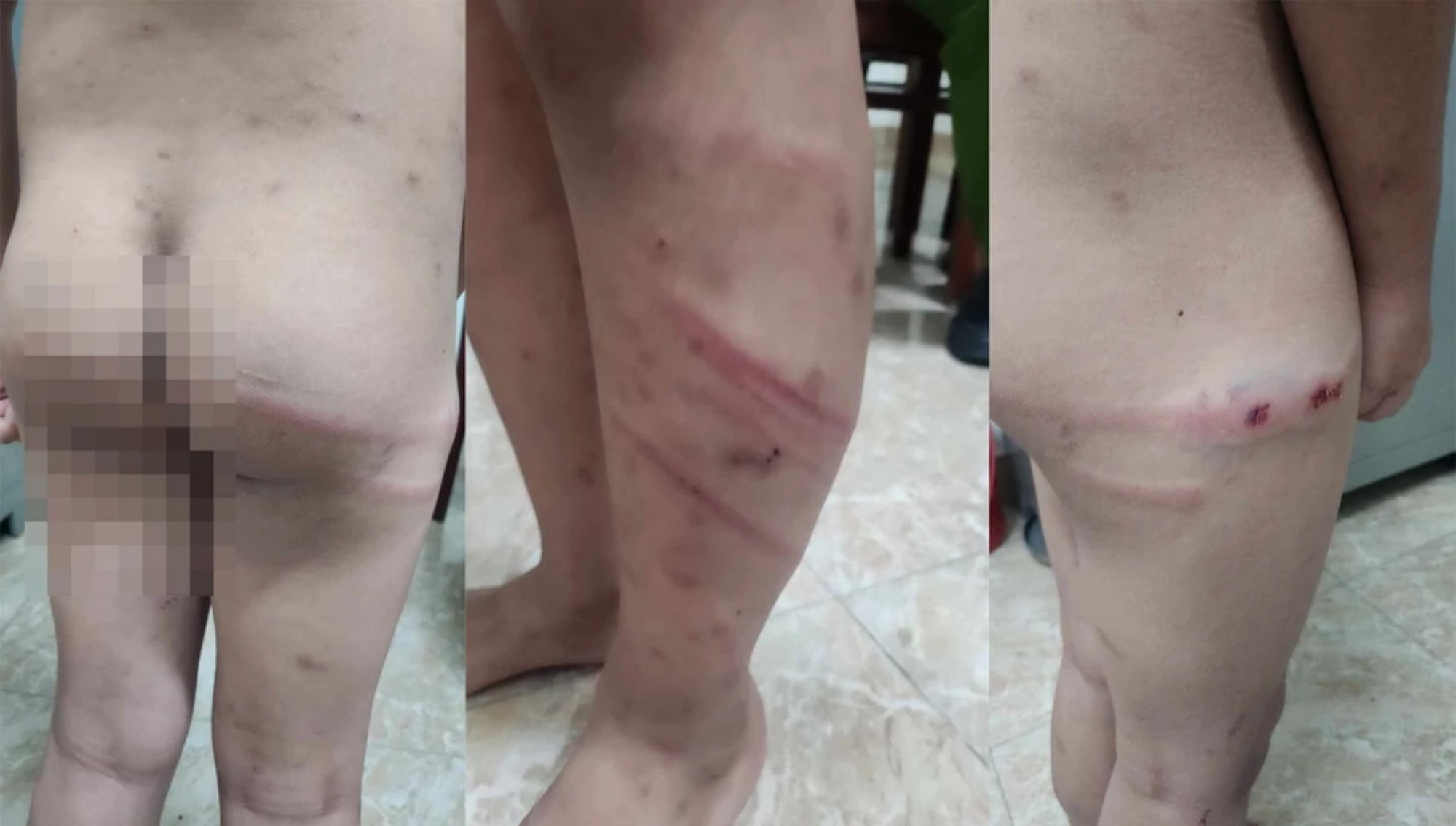 Điều tra việc b&eacute; 11 tuổi nghi bị bạo h&agrave;nh d&atilde; man- Ảnh 1.