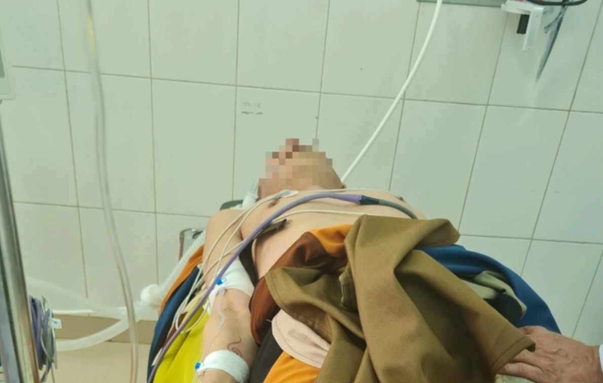 Say nắng, sốc nhiệt có thể gây suy đa tạng, tử vong: cần xử trí ra sao?- Ảnh 1. Say nắng, sốc nhiệt có thể gây suy đa tạng, tử vong: cần xử trí ra sao?- Ảnh 1.