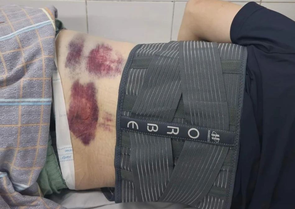 C&ocirc;ng an v&agrave;o cuộc vụ bảo vệ doanh nghiệp đ&aacute;nh người để xe m&aacute;y tr&ecirc;n vỉa h&egrave; ở Quảng Ninh- Ảnh 1.