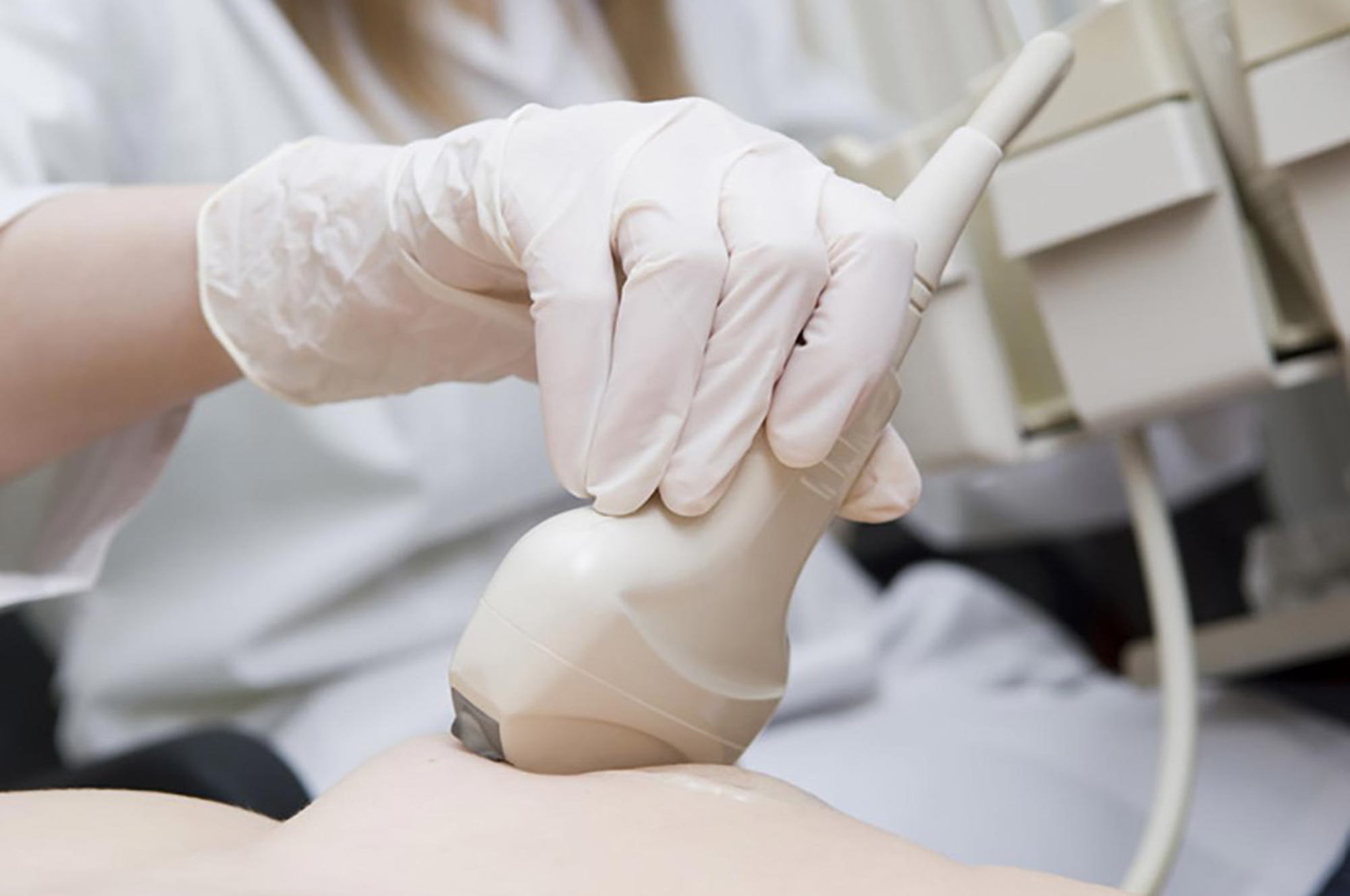 Bệnh nhân ung thư vú ngày càng trẻ hóa- Ảnh 2. Bệnh nhân ung thư vú ngày càng trẻ hóa- Ảnh 2.