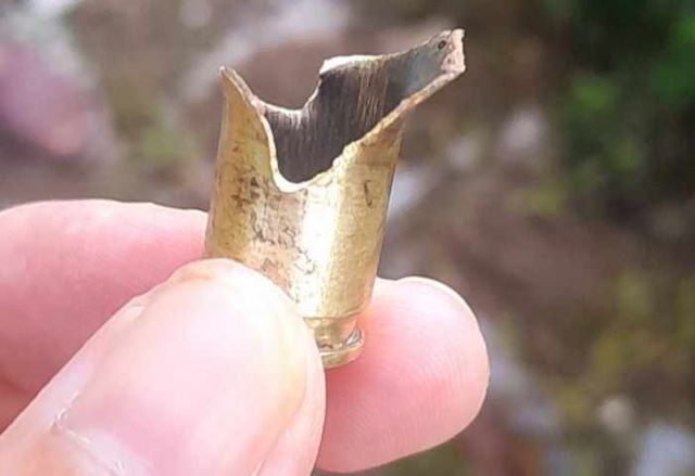 Người đàn ông suýt mất mạng vì cuốc đất trúng viên đạn- Ảnh 2. Người đàn ông suýt mất mạng vì cuốc đất trúng viên đạn- Ảnh 2.