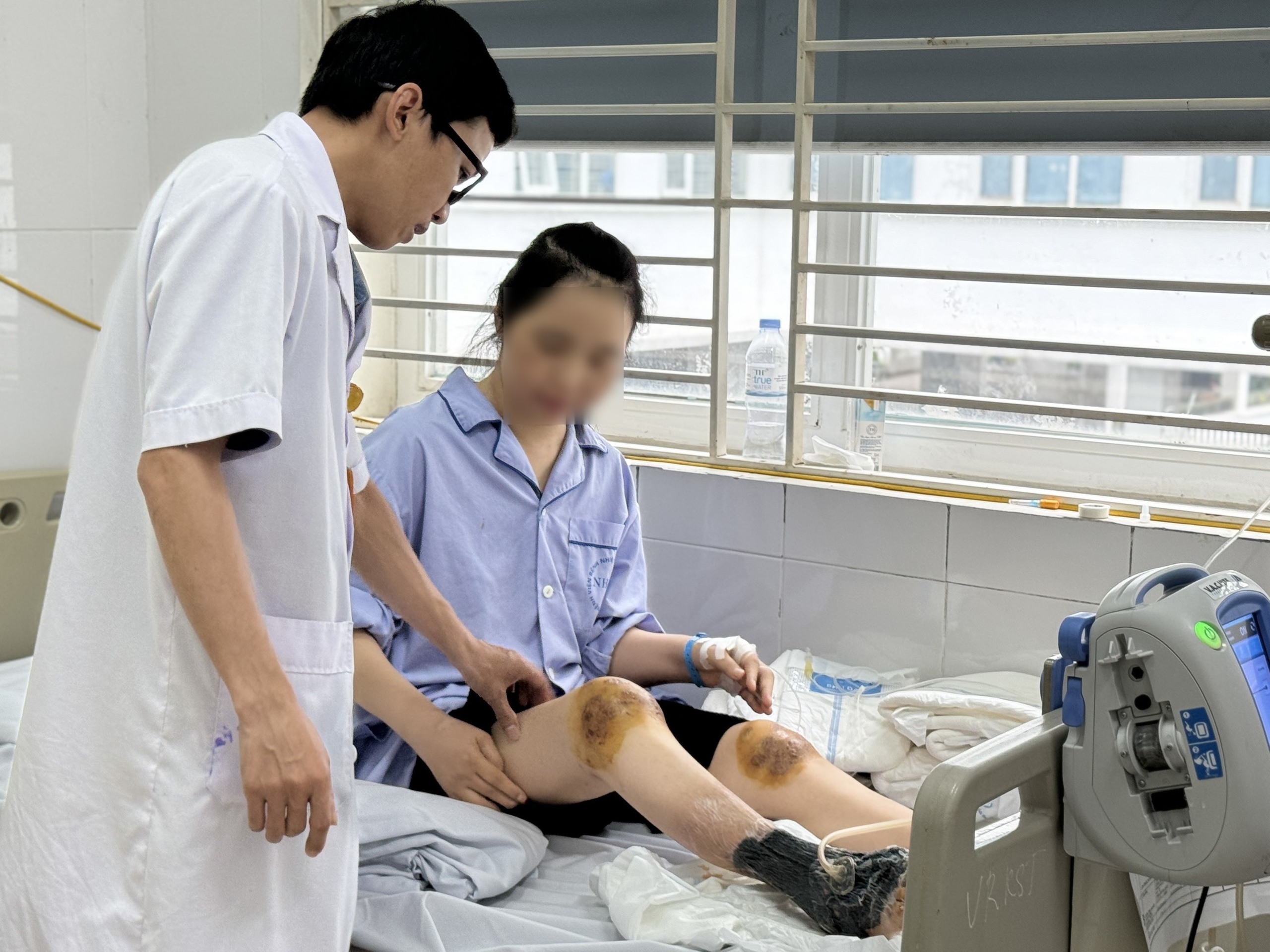 Để ong ch&acirc;m khớp gối chữa bệnh, một phụ nữ nguy kịch- Ảnh 1.