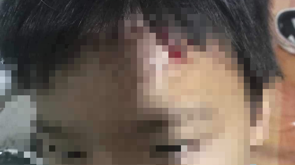 B&eacute; trai 10 tuổi nghi bị mẹ kế bạo h&agrave;nh ở C&agrave; Mau do l&agrave;m hư m&aacute;y lạnh?- Ảnh 1.