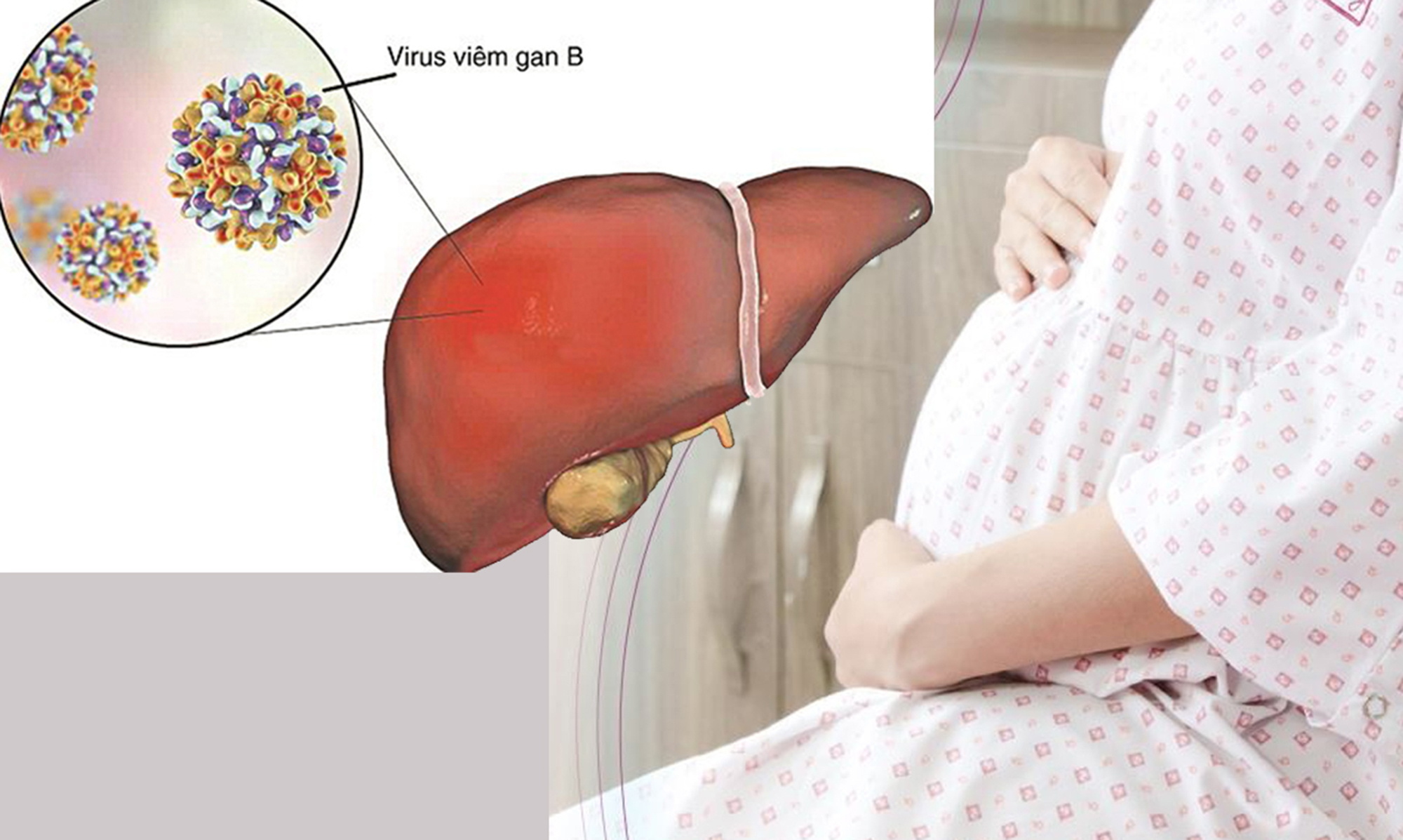 Virus vi&ecirc;m gan B ảnh hưởng đến thai phụ ra sao?- Ảnh 1.