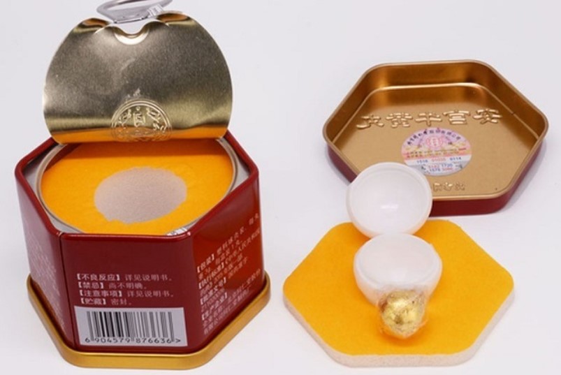 Bệnh nh&acirc;n đột quỵ n&atilde;o nặng th&ecirc;m v&igrave; uống An cung ngưu ho&agrave;ng ho&agrave;n- Ảnh 1.