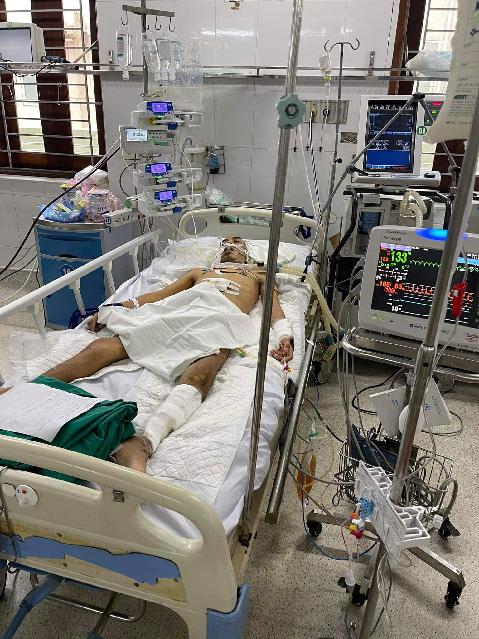 Chưa hết tai nạn lại đến tai ương, gia đ&igrave;nh nạn nh&acirc;n TNGT l&acirc;m cảnh khốn c&ugrave;ng- Ảnh 1.