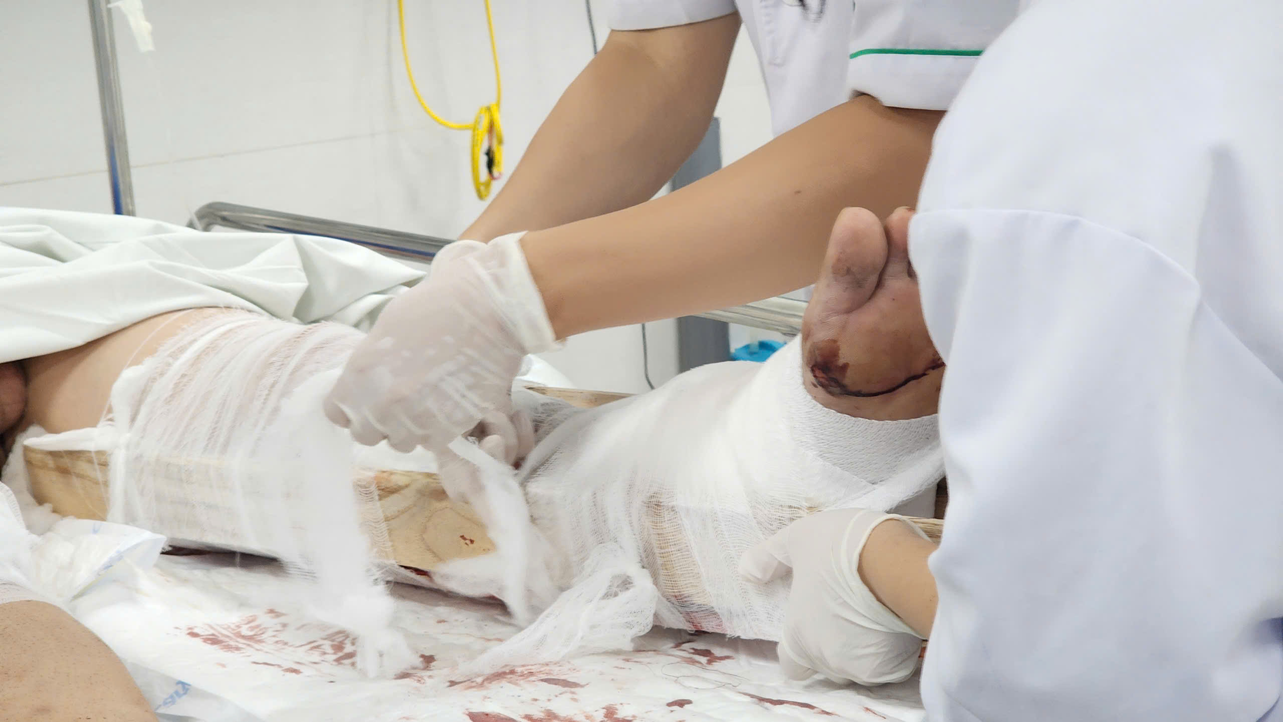 Sau li&ecirc;n hoan dịp lễ, nhiều người mở mắt thấy m&igrave;nh trong bệnh viện- Ảnh 5.