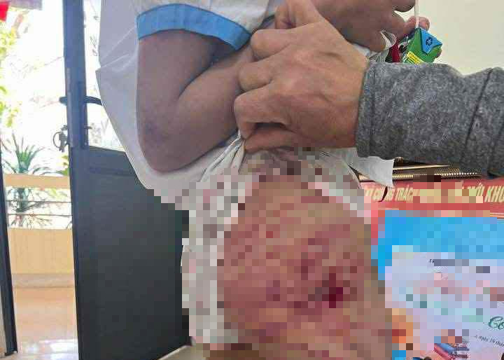 H&agrave; Tĩnh: X&aacute;c minh vụ b&eacute; g&aacute;i lớp 5 nghi bị cha dượng bạo h&agrave;nh- Ảnh 1.
