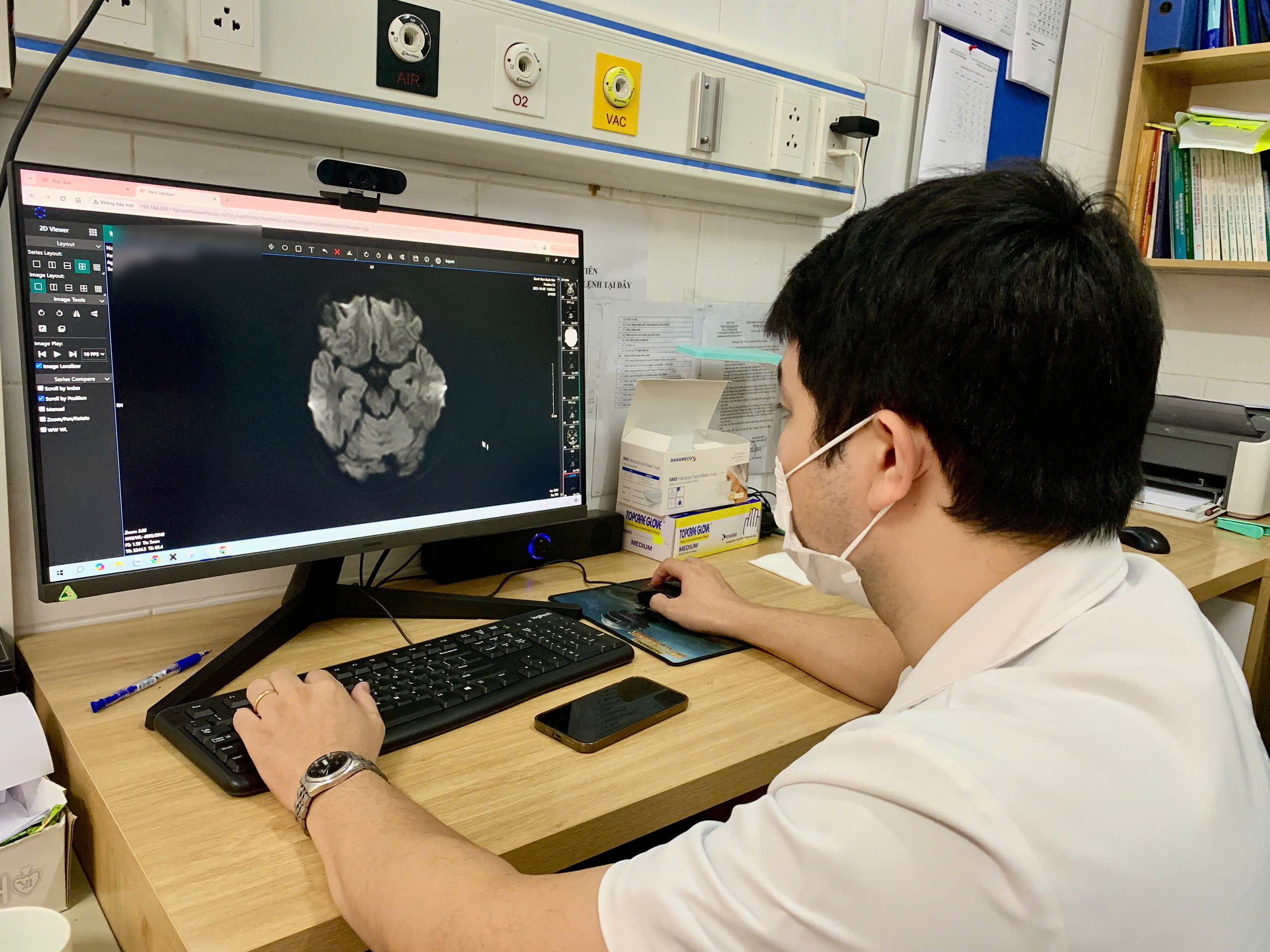 Nam sinh rối loạn t&acirc;m thần, tổn thương n&atilde;o v&igrave; thuốc l&aacute; điện tử- Ảnh 1.