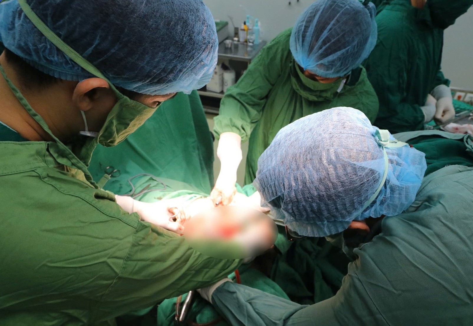 Th&agrave;nh c&ocirc;ng cắt khối u tử cung "khủng" nặng 1,7kg, giữ cơ hội l&agrave;m mẹ cho nữ bệnh nh&acirc;n- Ảnh 1.